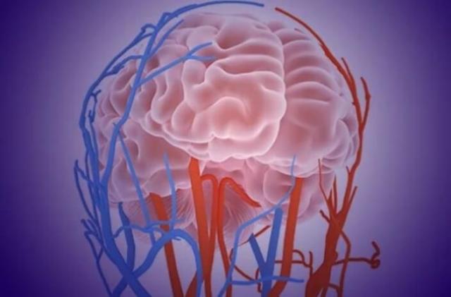 Best Brain Hemorrhage Health Center in Surat – Why Choose Us?