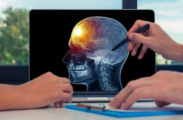 The Latest Innovations in Brain Tumour Treatment Available in Gujarat